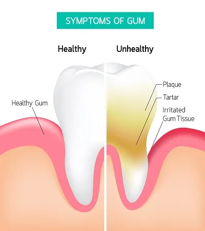 Tooth chart