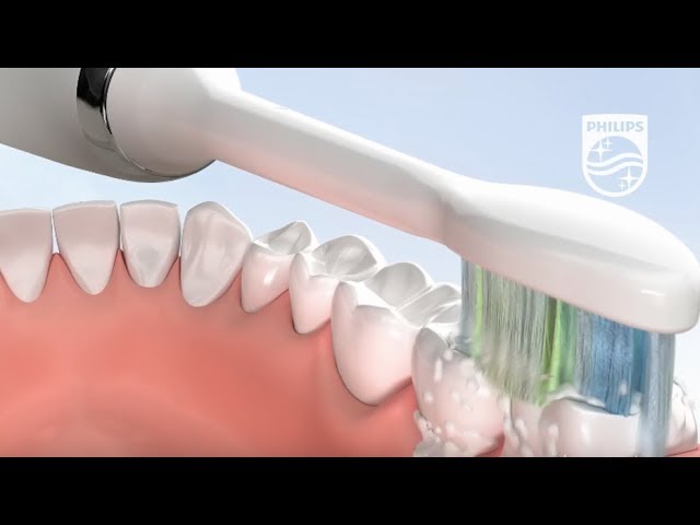 How to brush with Sonicare DiamondClean